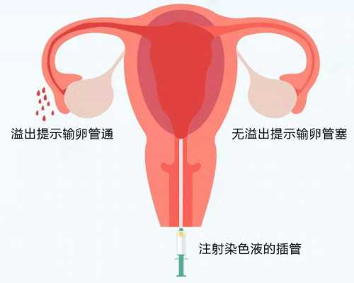 沈阳代孕妈价格,2022年在上海一妇婴做一次试管婴儿成功率有多高？
