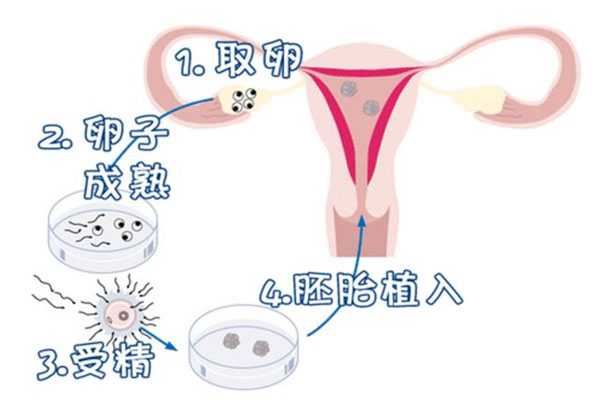 忻州试管代孕条件,超详细试管婴儿的十大具体步骤流程-上海正规供卵试管婴儿